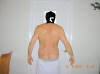 Lower Body Lift Surgery After Two Weeks