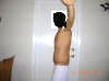 Abdominoplasty Plastic Surgery After 2 Weeks showing left side. tummytuckformen.com
