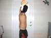 Tummy Tuck Before And After Pictures - Tummy Tuck for Men; Abdominoplasty Plastic Surgery After 2 days showing wound and sutures - right side. tummytuckformen.com